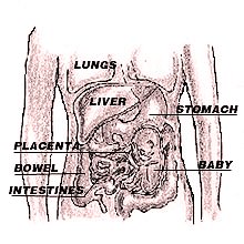 preg-man.jpg (18157 bytes)